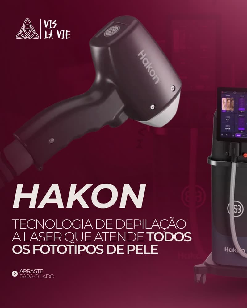 Hakon, laser de depilação que atende todos os fototipos de pele, na locação da Vis La Vie